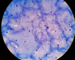 Parasitology Jobs Profile - microfilaria tissue parasite infection to human in parasitology.